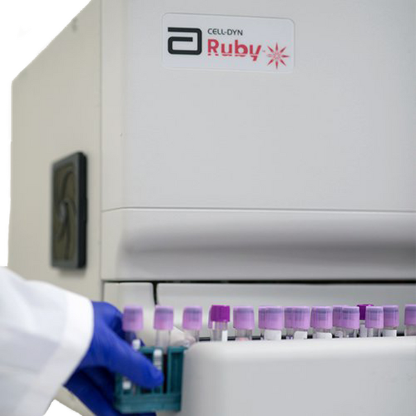 Abbott Cell-Dyn Ruby