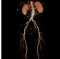 GE Healthcare Revolution Discovery CT