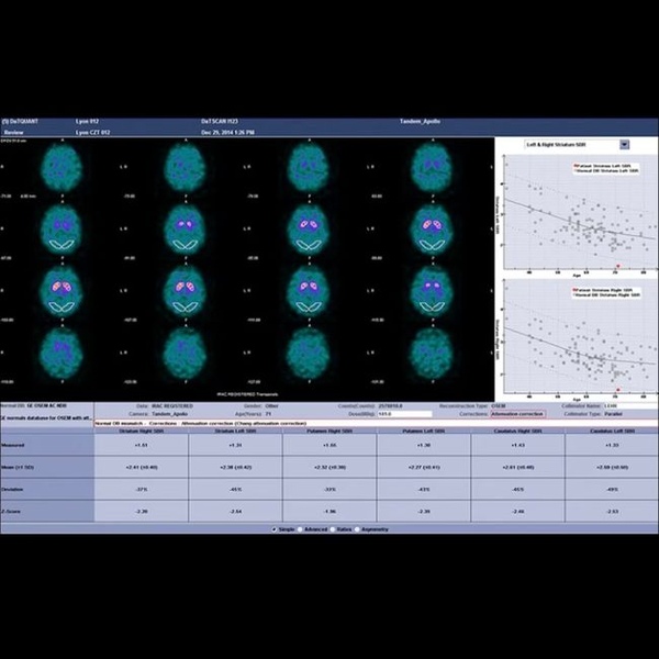 GE Healthcare NM/CT 870 DR