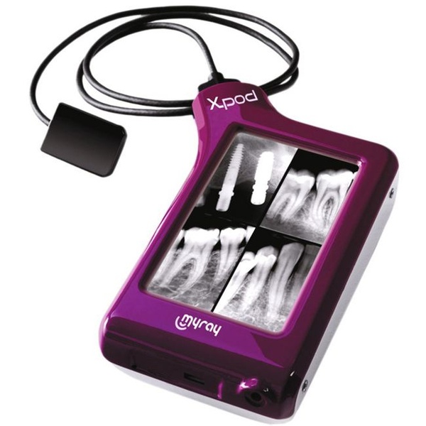 MyRay Х-pod