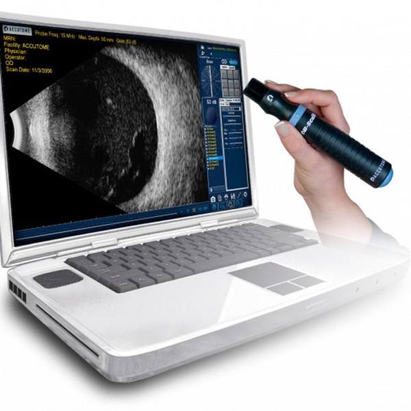 Accutome by Keeler B-scan Plus