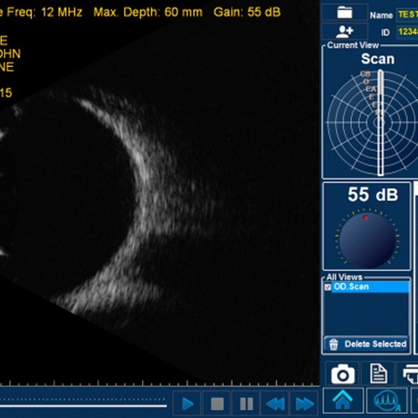 Accutome by Keeler B-scan Plus