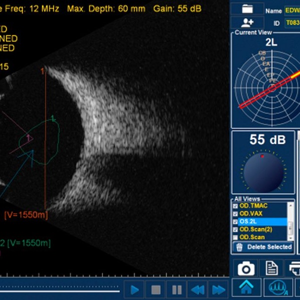 Accutome by Keeler B-scan Plus