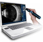 Accutome by Keeler B-scan Plus