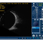 Accutome by Keeler B-scan Plus