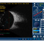 Accutome by Keeler B-scan Plus