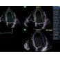 GE Healthcare Vivid IQ