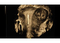 GE Healthcare Voluson E8