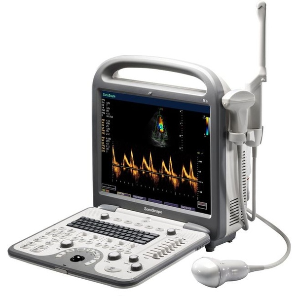 Sonoscape S8N