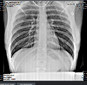Dexcowin iRayA6 (ADX6000FB)