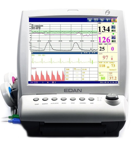 Edan F9 Express