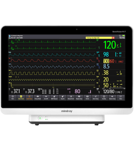 Mindray BeneVision N17