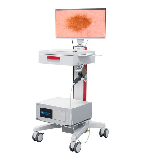 FotoFinder Dermoscope Vexia