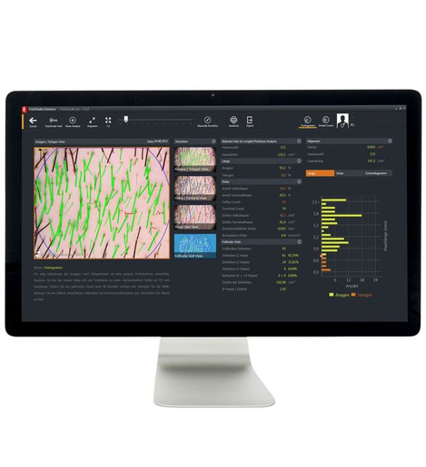 FotoFinder Trichovision