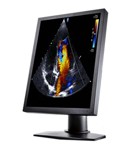 Double Black Imaging 2MP Color Clinical LCD