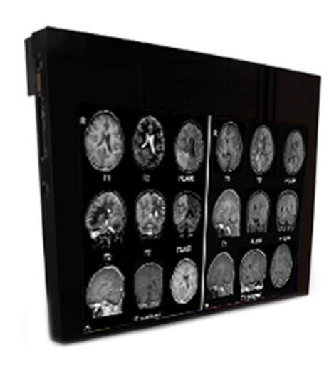 Double Black Imaging 32 MRSafe Display