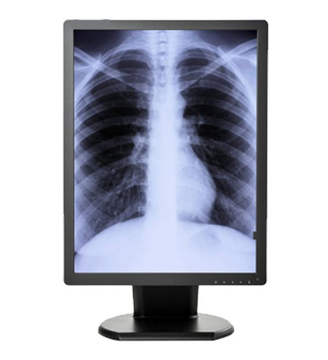 Double Black Imaging 3MP Monochrome Diagnostic Display