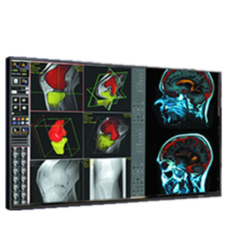 Double Black Imaging 42 Professional LCD