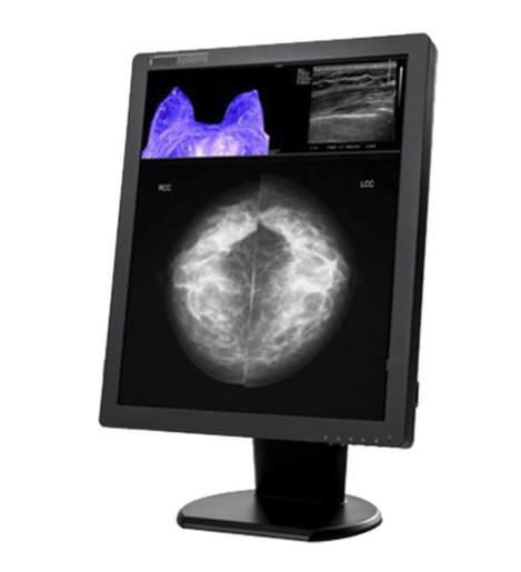 Double Black Imaging Image Systems 5MP Color Diagnostic Display (C5MPN)