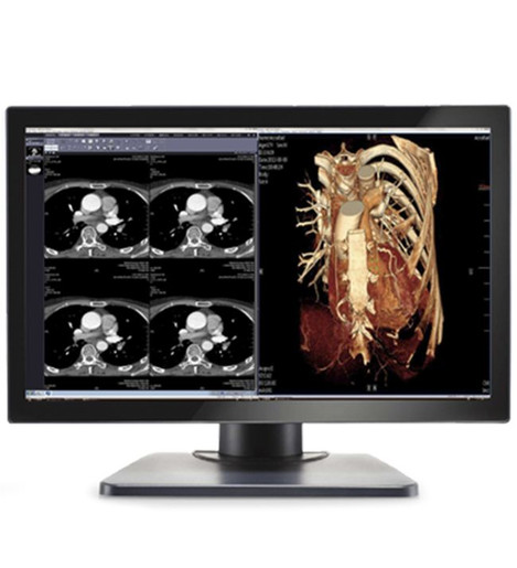 Double Black Imaging Image Systems Gemini 4MP Large Format Display