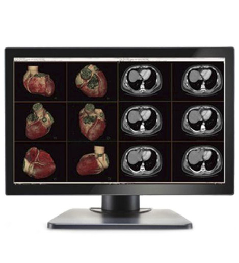 Double Black Imaging Image Systems Gemini 6MP Large Format Display