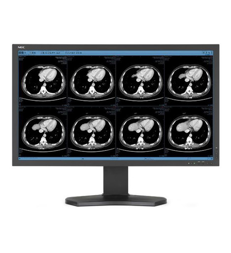 NEC MD322C8-2