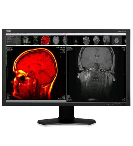 NEC MDview 243