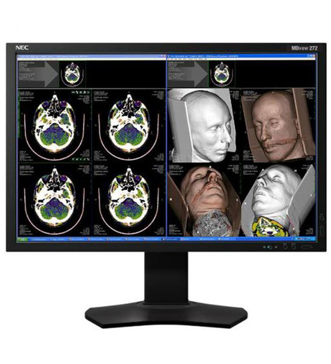 NEC MDview 272