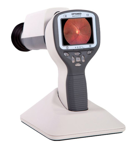 Optomed Smartscope M5