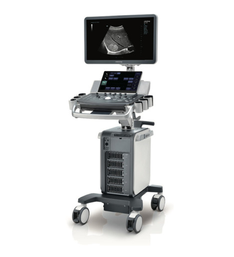 Mindray DC-90 X-insight