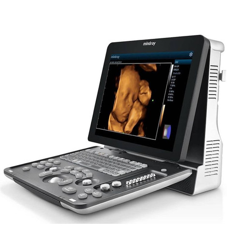 Mindray Z60