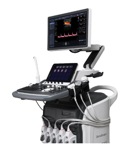 Sonoscape S40