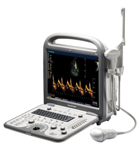 Sonoscape S8N